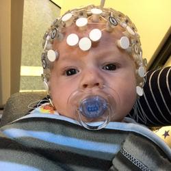 Babies wearing 'head cap' to measure electrical brain activity
