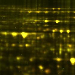 Gel electrophoresis