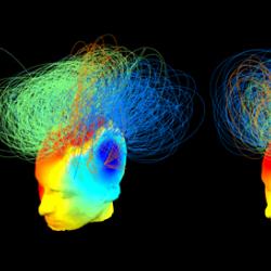 Brain signals from healthy and vegetative state patients