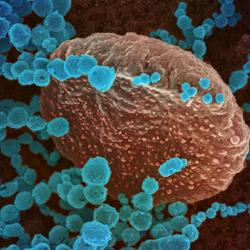 Novel Coronavirus SARS-CoV-2