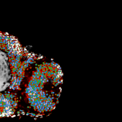 Brain of a frog embryo. The coloured structures are cell nuclei (containing DNA), the white structure in the center corresponds to the optic tract, which contains the neuronal axons studied.