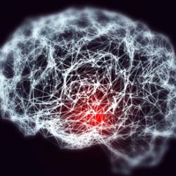 Conceptual image showing blurred brain with loss of neuronal networks