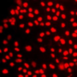 Differentiation of human Induced Pluripotent Stem Cells (hIPSC) to functional liver hepatocyte cells