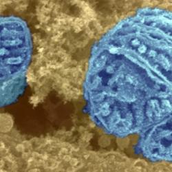 Three mitochondria surrounded by cytoplasm