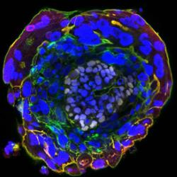 Imaging a human embryo in the absence of maternal tissues - day 10 (left) and day 11 (right)