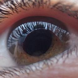 Eye