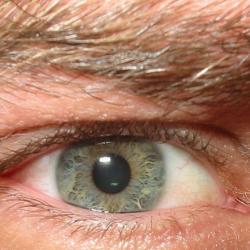 Eye