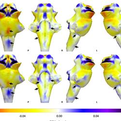 3D projections of QSM maps on the rendered brainstem