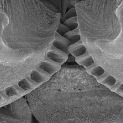 Cog wheels connecting the hind legs of the plant hopper, Issus