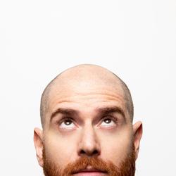 Bald young man, front view 