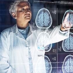 Futuristic image of a doctor looking at brain scans