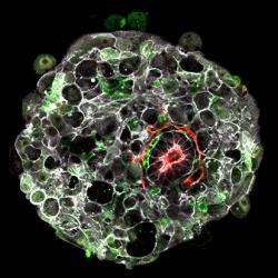 Human embryo in the lab 9 days after fertilisation.