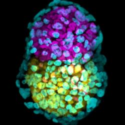 Synthetic embryo-like structure made of three stem cells types in yellow, pink and green