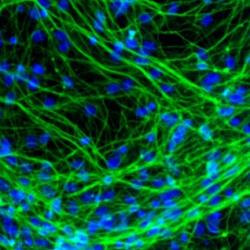 Neurons derived from human neural stem cells 