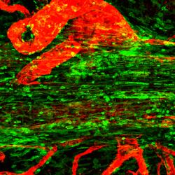 Confocal micrograph showing the superior saggital sinus in the mouse. Immune cells are shown in green lining this tube, and blood vessels in red