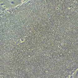 iPS cell colony