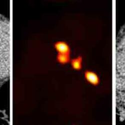 From left to right, CT, PET and combined PET/CT images of the heart arteries.