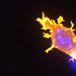 Killer T-cell
