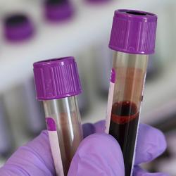 Test tubes containing blood