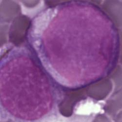 A Surprising New Path to Tumor Development