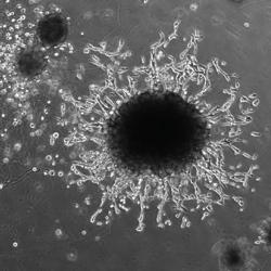 Microscopic image of placental organoids