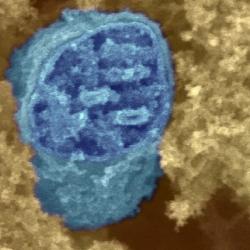 Mitochondria surrounded by cytoplasm