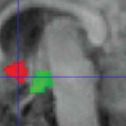 Functional MRI scan