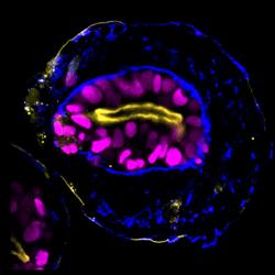 Day 4 embryoid