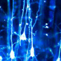 parkinsons neurons
