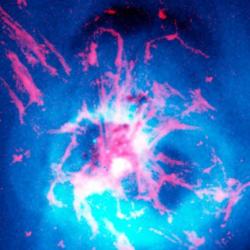 Perseus alpha x-rays