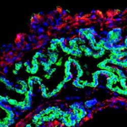 mage of a mouse gallbladder following repair with a bioengineered patch of tissue incorporating human 'bile duct' cells, shown in green. The human bile duct cells have fully repaired and replaced the damaged mouse epithelium