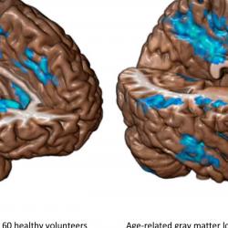Molecular Psychiatry