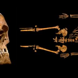 Skull and bones of Richard III