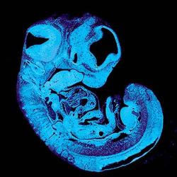 Section of mouse fetus and placenta