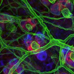 Stem cells