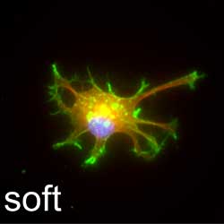 Astrocyte grown on soft substrate