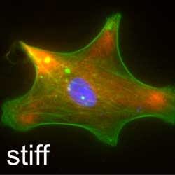 Astrocyte grown on stiff substrate