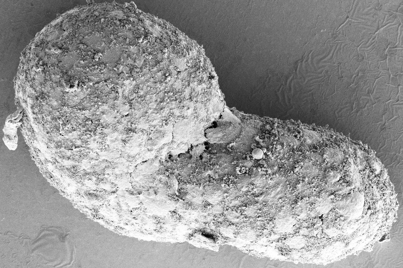 72 hour human gastruloid by Scanning Electron Microscopy