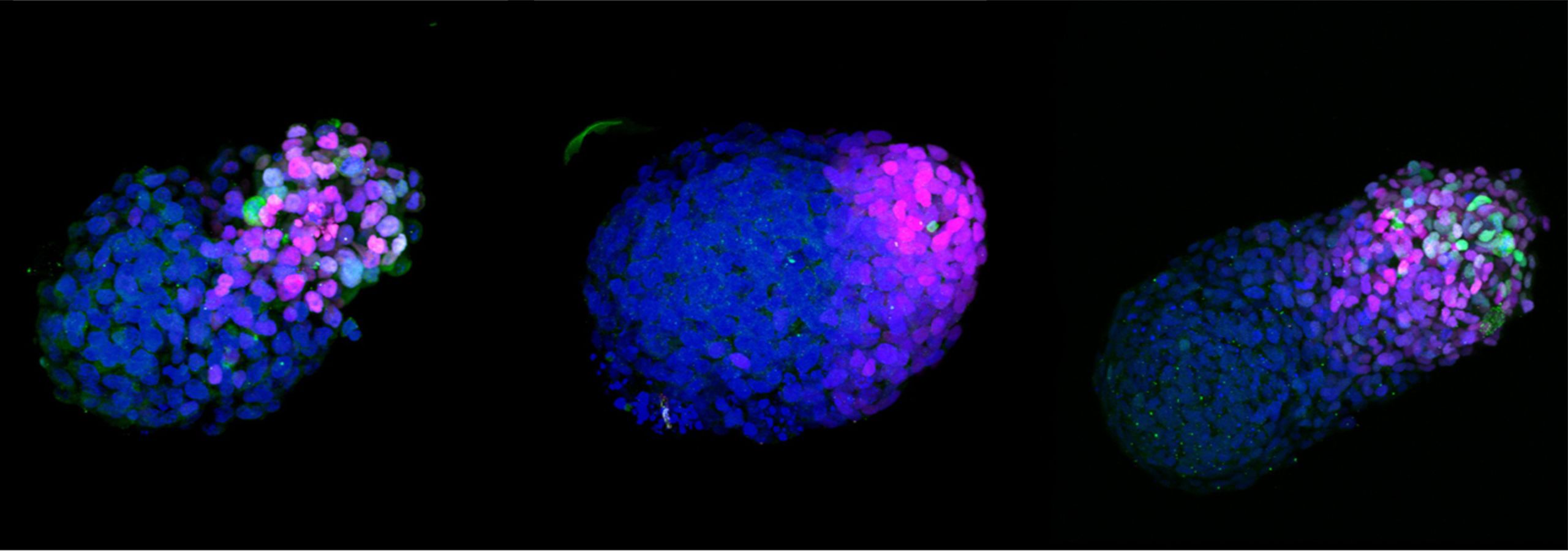 A growing human gastruloid at 24 hours (left), 48 hours (middle) and 72 hours (right)