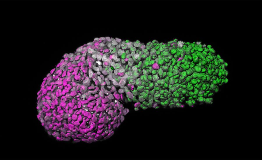 Image analysis of human gastruloid showing ‘anteroposterior’ patterning. Green is the posterior part, similar to the tail-end of an embryo; magenta is the anterior part, similar to developing heart cells; grey marks DNA.