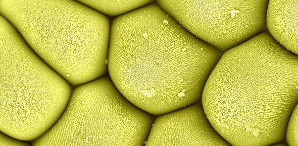 False coloured conical cells on a daffodil petal, imaged using cryo-SEM. Credit: Raymond Wightman.