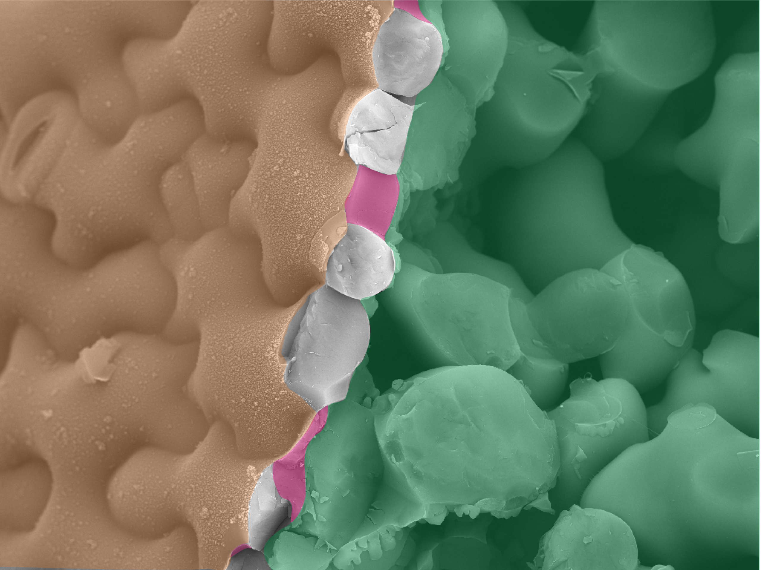 Researchers used sound to analyse the wavy puzzle-shaped cells on a plant’s epidermis. Credit: Raymond Wightman & Alexis Peaucelle.