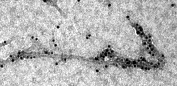 Transmission electron microscopy image showing a molecular chaperone (the black dots) binding to thread-like amyloid-beta (Aβ42)