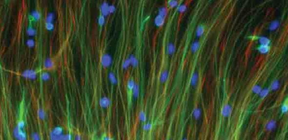 human neural stem cells 