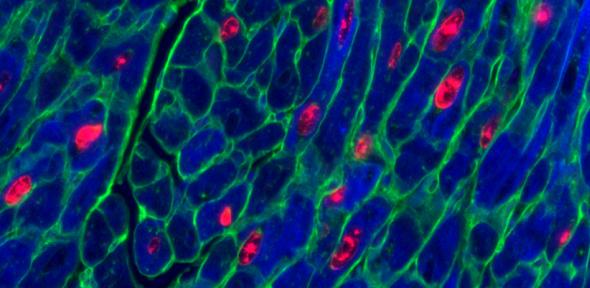 Adult mouse heart muscle cells (blue) after activation of both proteins vital for cell replication. Red shows cells replicating, green marks cell membrane.