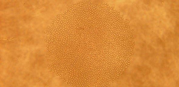 A small colony of cells derived from a single blood stem cell.  Hundreds of such colonies were assessed for their proliferation kinetics and blood cell types produced.  