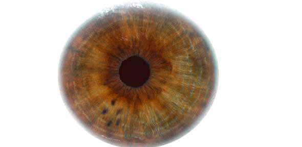 Iris (eye)
