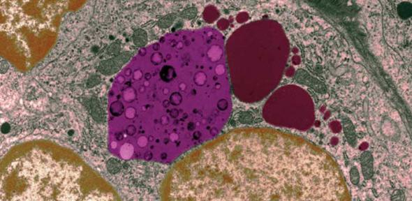 Molecular sacs of debris (pink) are delivered to the lysosome (dark red)