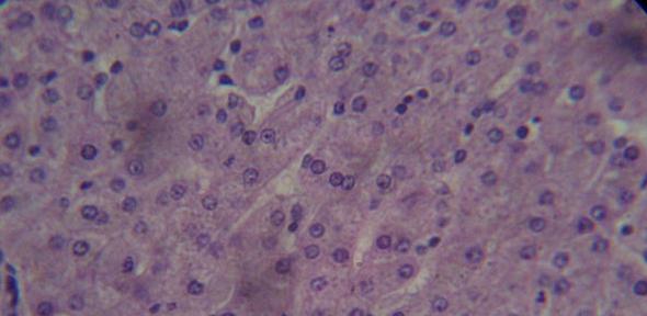 Human liver cells