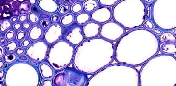 Plant cells, like these in wheat, are surrounded by thick walls where energy is locked up.